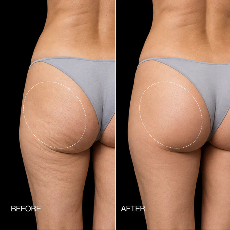 Azerla EMS Toning Shorts
