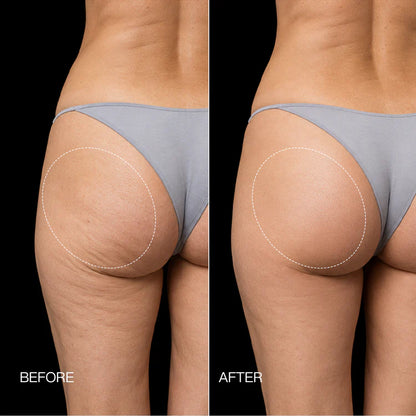 Azerla EMS Toning Shorts