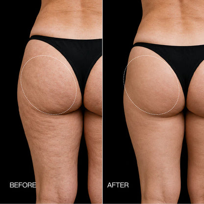 Azerla EMS Toning Shorts